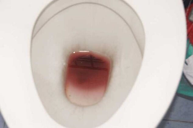 κηλίδες στους άνδρες όταν είναι ενθουσιασμένοι